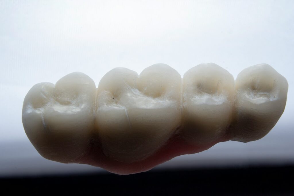 dental ceramic bridge